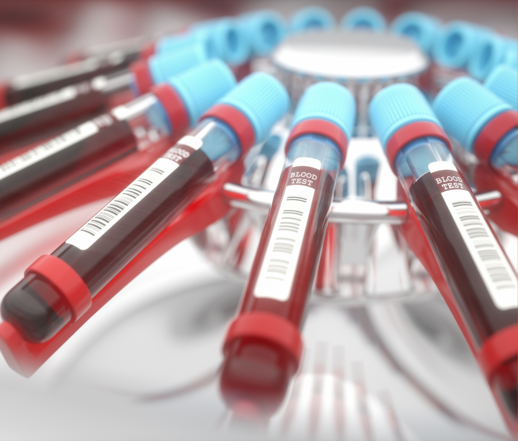 Blood sugar Test