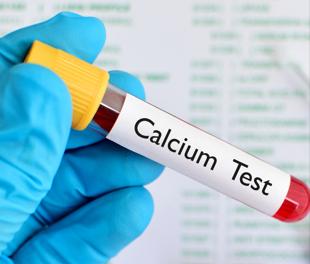 Calcium Test