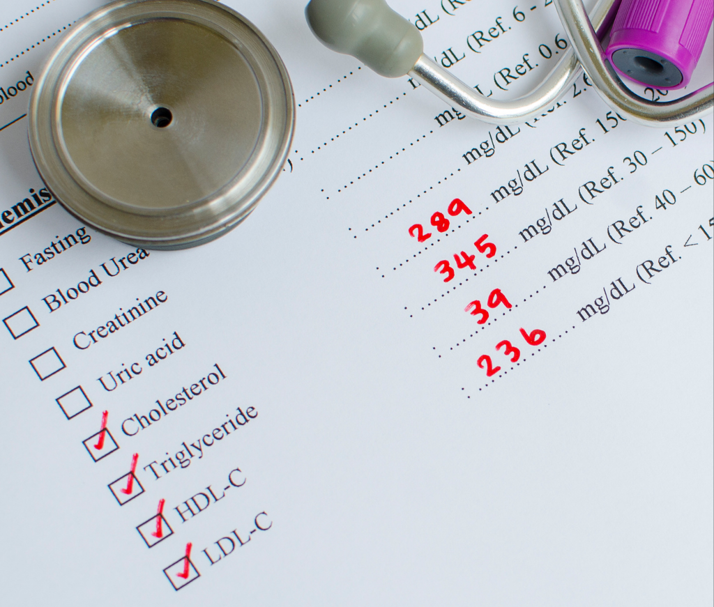 Lipid Profile Test