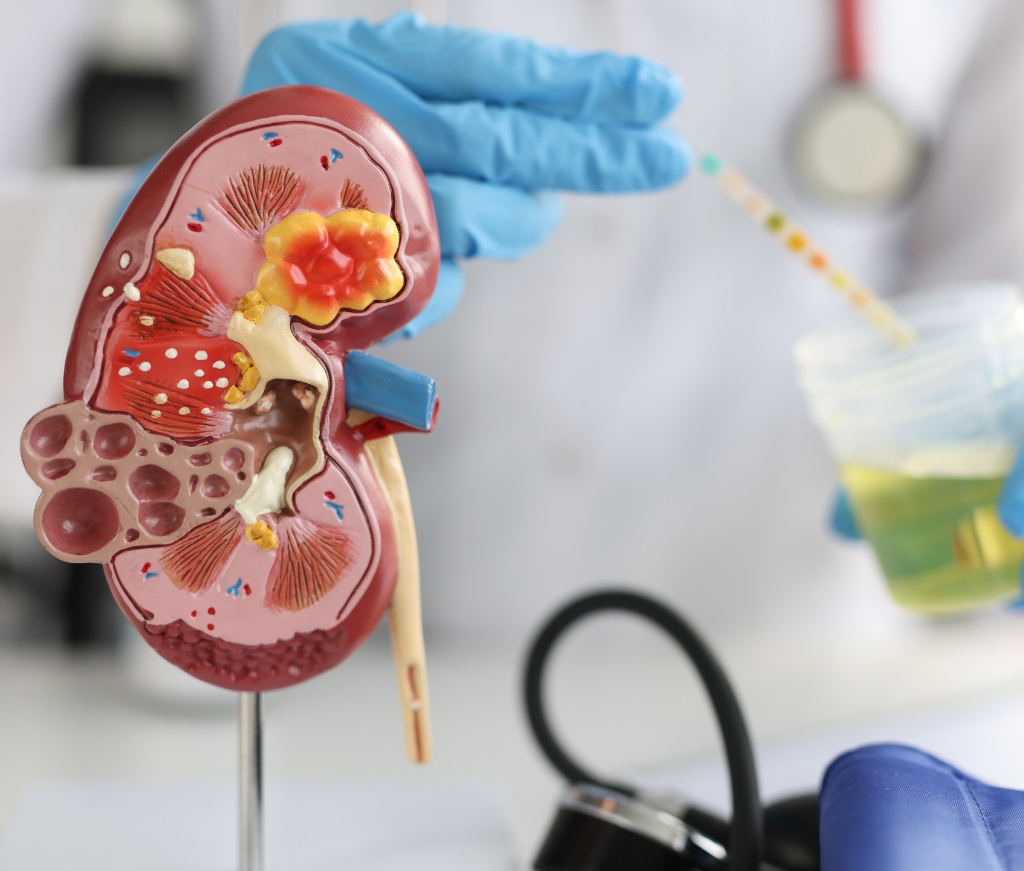 Kidney Function Test