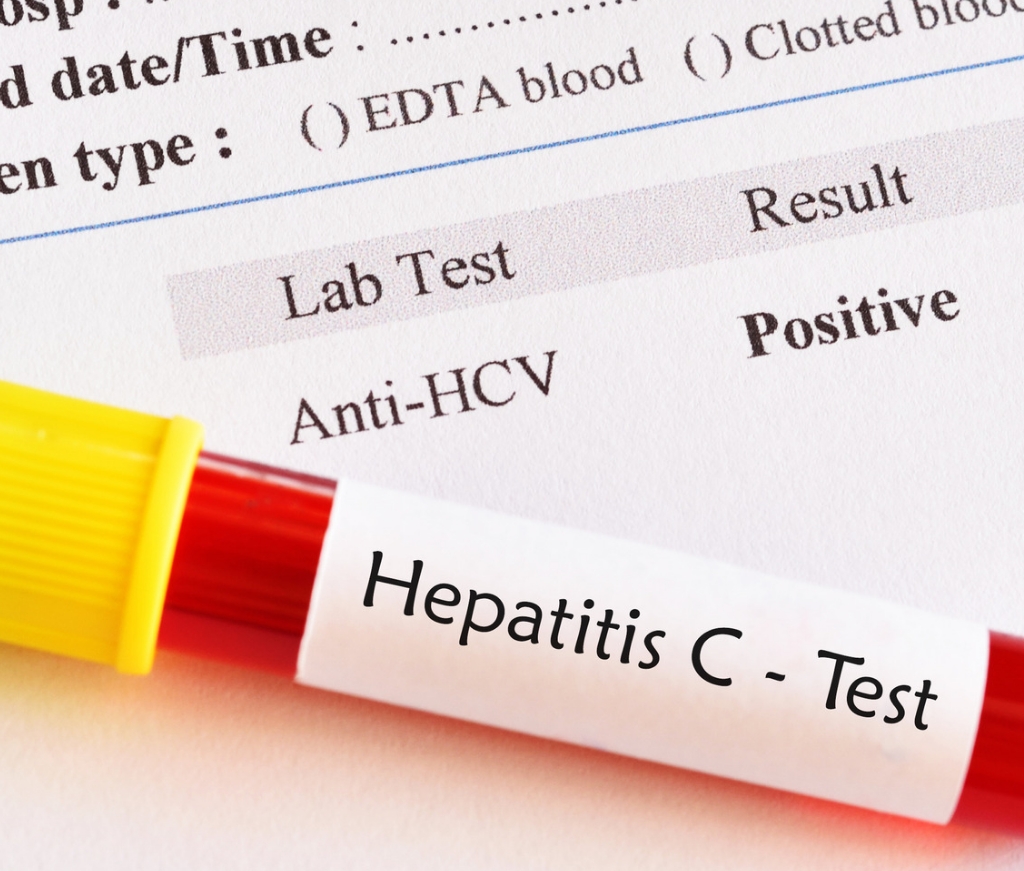 HCV genotyping