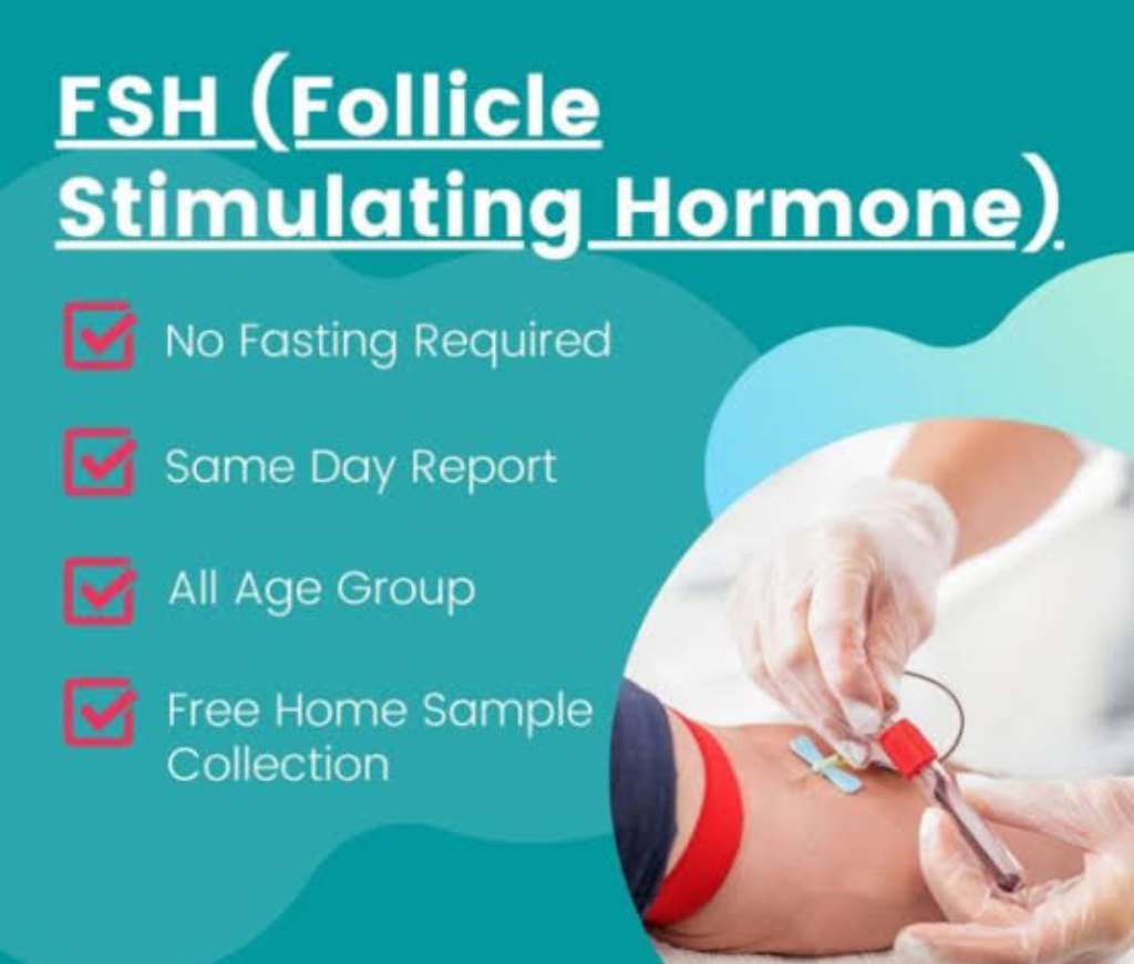 Follicle Stimulating Hormone (FSH) Levels Test